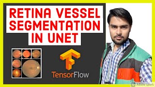 Retina Blood Vessel Segmentation using UNET in TensorFlow 2.0 (Keras) | Image Segmentation