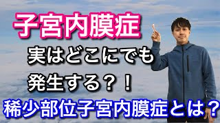 稀少部位子宮内膜症とは？！