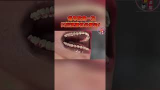 每年一次的口腔健康检查有必要吗？#牙齿 #口腔卫生