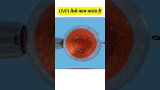 How does IVF happen? The complete process of in vitro fertilization | Know the science of becomin...