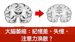 大腦萎縮嗎？記憶差,注意力渙散,再生腦細胞有方法,自然療法,柏格醫生Dr berg