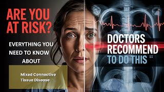 Mixed Connective Tissue Disease Explained Causes, Symptoms and Treatment, All Insights