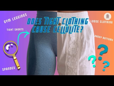 I switched to Loose Clothing: Does Tight Clothing Cause Cellulite?