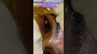 கண்சுத்தம்#eyetracking#eyetreatment#eyecare#netra#skincare#headache#beauty#pollution#dusty#kerala