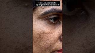 Demelan Cream for Dark Spots & Pigmentation | Dermatologist Recommended #darkspots