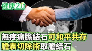無疼痛膽結石可和平共存 膽囊切除術取膽結石【健康2.0 分段】 @tvbshealth20  EP3025-2  20250517 #鄭凱云#朱光恩#王健宇#陳麗華#宋明樺