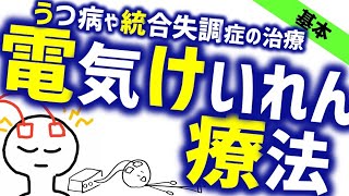 電気けいれん療法［基本］うつ病や統合失調症の治療法 ECT