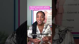 Is hysterectomy the only option for fibroids? Nope! Here are 3 other options to know. #fibroids
