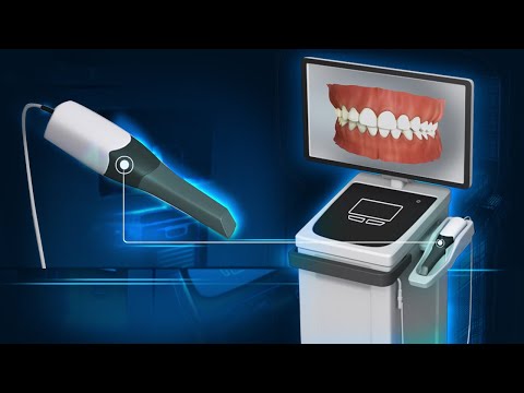 Dental Animation | Dental Scanner | Digital Laboratory