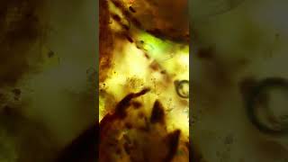 Worm Fight under the Microscope #microscope #science
