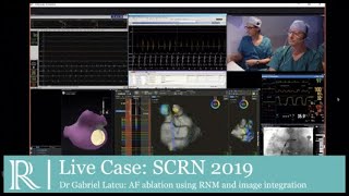 SCRN: AF Ablation using RMN and image integration