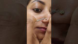 💯Remove Whiteheads in 5 Minutes | Easy Skincare Hack! #whiteheads #skincare #atypical_anjana