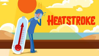 What are early signs of heat stroke? How to treat heat stroke? How to avoid heatstroke?
