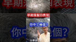 早期落髮四表現 #皮膚科醫生  你中了幾個🤔 #吳仁欽皮膚科診所 #醫美 #屏東微整 #567 #微針筆 #禿頭 #痘痘 #外泌體 #育髮 #雄性禿 #養髮液 #髮際線 #痘疤 #色素 #膠原蛋白