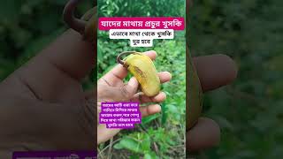 খুসকি দুর করুন সহজে