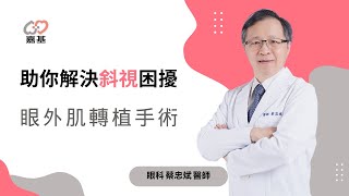 助你解決斜視困擾 眼外肌轉植手術 by 蔡忠斌 醫師
