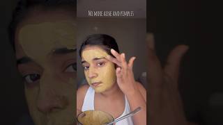 No more acne and pimples😳😱 #multanimitti #nomoreacne #nomorepimes #facepack #pimples #acne