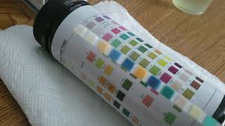 How To Read Urine Test Strips