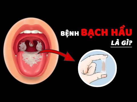 Hiểu Rõ Về Bệnh Bạch Hầu...Chắc Chắn Bạn Chưa Biết Những Điều Này!