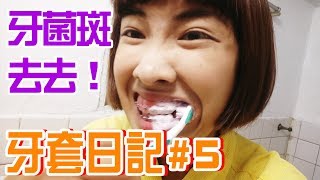 牙套日記#5 牙菌斑去去！美白牙膏讓我拒當黃牙人?!｜移動岑寶