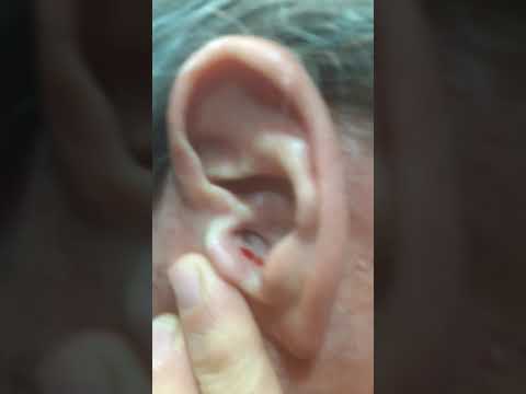 itchy ears part 1