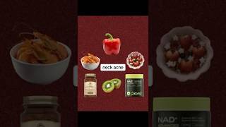 #neckacne #acne  #acnetips  #recommendations  #recommended  #vitamins