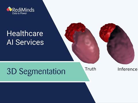 3D Kidney and Tumor Segmentation | RediMinds Healthcare AI Services