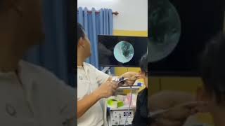 Microscopic Wax Extraction by ENT! 🔬✨ #EarCare #Shorts