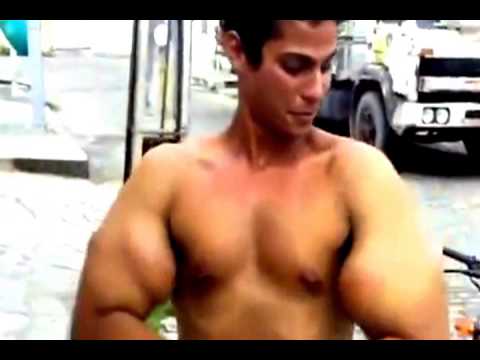 My new Bicep implants ROCK!