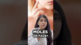 How to get rid of moles on skin | How to remove moles on face | Moles treatment dermatologist