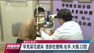 男子眼睛長菜花 疑三溫暖或公廁座墊傳染｜20230605 公視晚間新聞