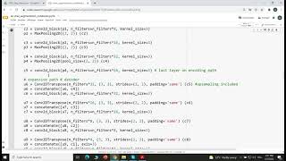 UNET demo