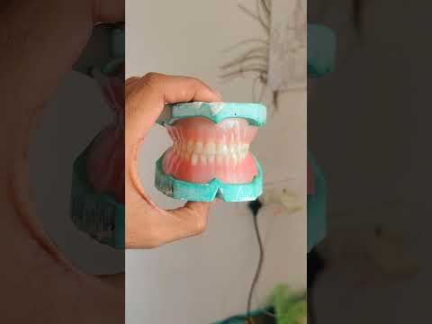Create smile 😁//#dentalprosthesis #dentalartistry #viral #newtending #new #newreels #completedenture