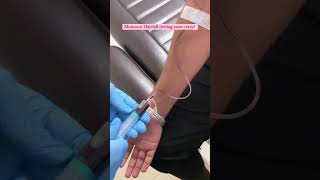 {2024) Hair PRP for Hair Loss | Platelet-Rich-Plasma Treatment #shorts