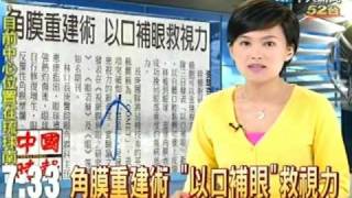 角膜重建術 「以口補眼」救視力