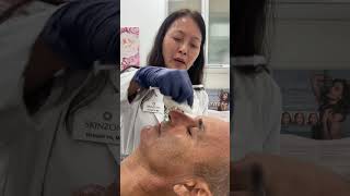 Non Surgical Rhinoplasty Dr Hannah Vu MD Skinzone Medical