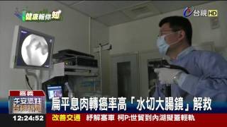 扁平息肉轉癌率高「水切大腸鏡」解救