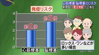 知っておきたい病気予防の最前線「心筋梗塞・脳梗塞」
