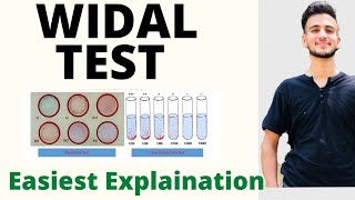 Widal Test in Hindi / Widal Test procedure / Widal Test