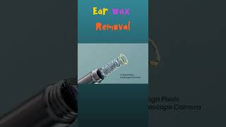 Ear Hygiene Made Simple: Smart Ear Wax Remover! 👂🔧 #HealthTech #smartgadgets