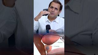 Stereotactic Body Radiation Therapy से कैसे prostate कैंसर की सर्जरी से बचा जा सकता हैं ?