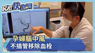 孕婦腦中風 不插管移除血栓－民視新聞