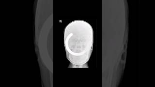 👨‍🦲머리 해부학 (skull) x-ray anatomy #headshot #head #xray #해부학 #뼈