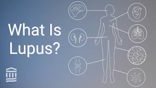 Understanding Lupus: Causes, Symptoms, Treatment, and Flare Ups | Mass General Brigham