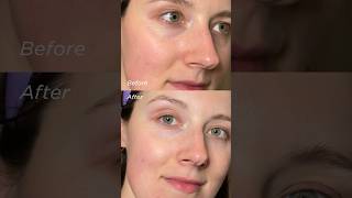 How to use enzyme powder | Using Green Tea Enzyme Powder Wash By Wishtrend | Before and after result