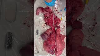 Why PEEP is so important 🫁 #paramedic #emt #ems #paramedicstudent #paramediclife