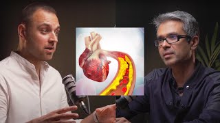 Dr Aseem Malhotra on The Truth About Cholesterol - CNM Podcast