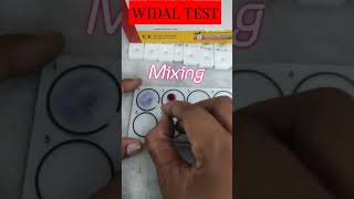 WIDAL test #viral