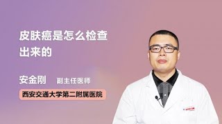 皮肤癌是怎么检查出来的 安金刚 西安交通大学第二附属医院