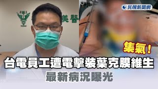 快新聞／集氣！台電員工遭電擊裝葉克膜維生　最新病況曝光－民視新聞